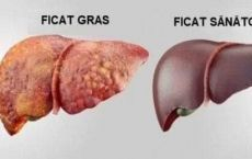 Solutii pentru ficat