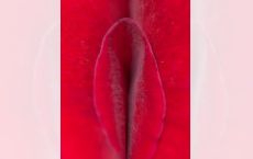 Интимная пластика: уменьшение малых половых губ (Лазерная Лабиопластика) в Кишиневе ,Молдове!
